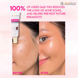 Gluvit-S Glutathione Skin Brightening Cream 30ml