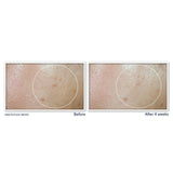 Roc Multi Correxion Even Tone + Lift Daily Moisturizer Spf 30