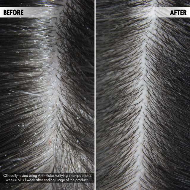 Oriflame DUOLOGI Anti Flake Purifying Shampoo (250ml)