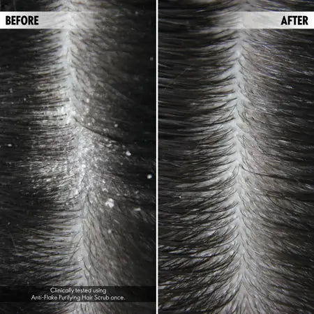 Oriflame Duologi Anti-Flake Purifying Scalp Scrub 75ml