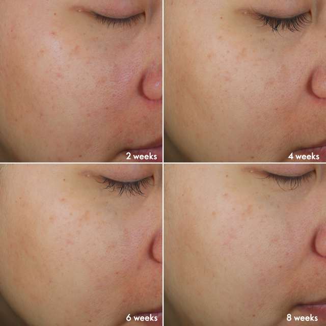 Oriflame NOVAGE+ Bright Intense Routine Mixed