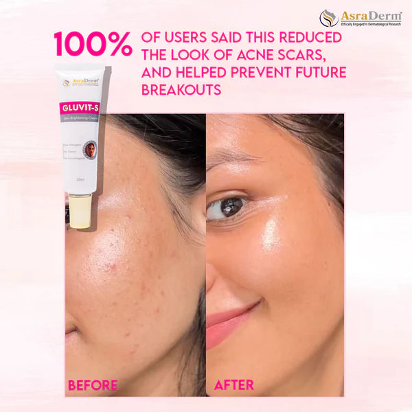 Gluvit-S Glutathione Skin Brightening Cream 30ml