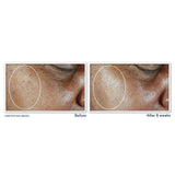 Roc Multi Correxion Even Tone + Lift Daily Moisturizer Spf 30